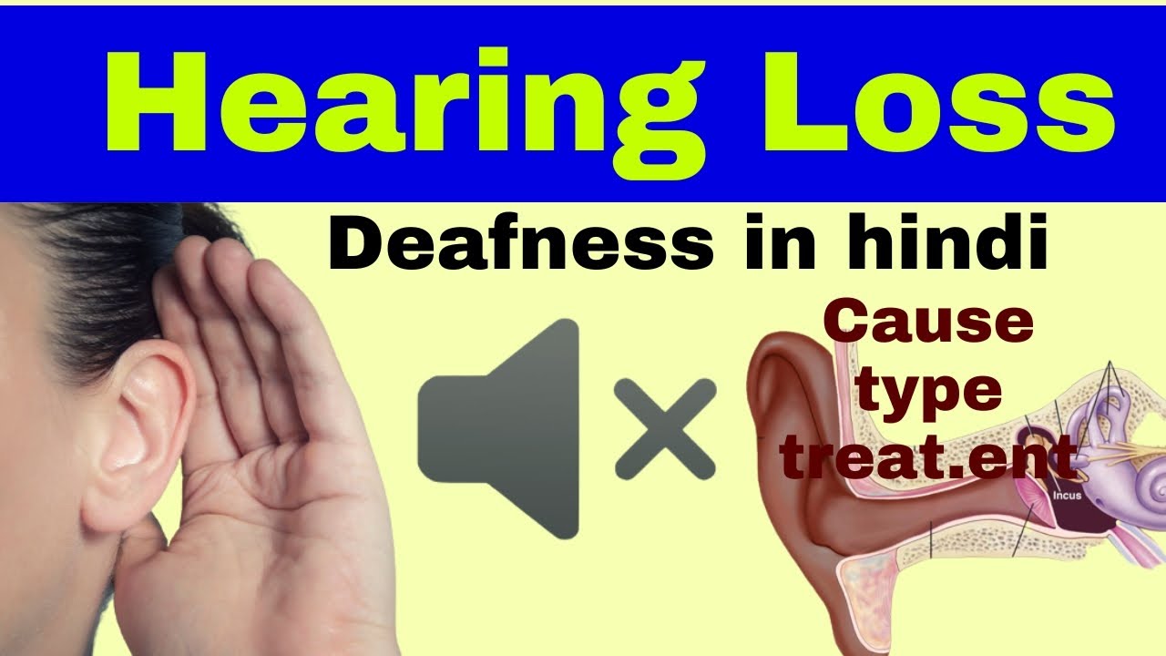 Hearing loss ( Deafness ) lecture in hindi sensorineural hearing loss