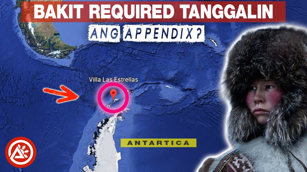 bakit-required-na-tanggalin-ang-appendix-ng-mga-tao-sa-antarctica