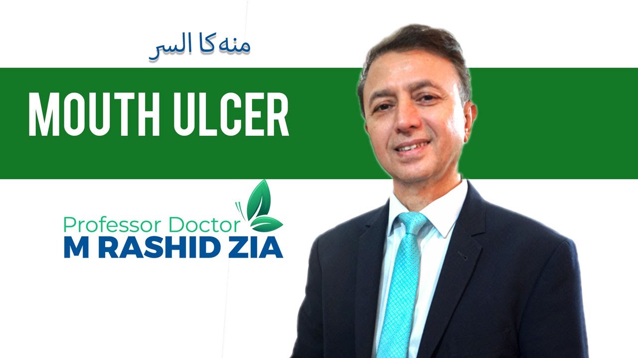 Mouth Ulcer | Mouth Ulcer treatment | ENT Specialist | Prof Dr M Rashid ...