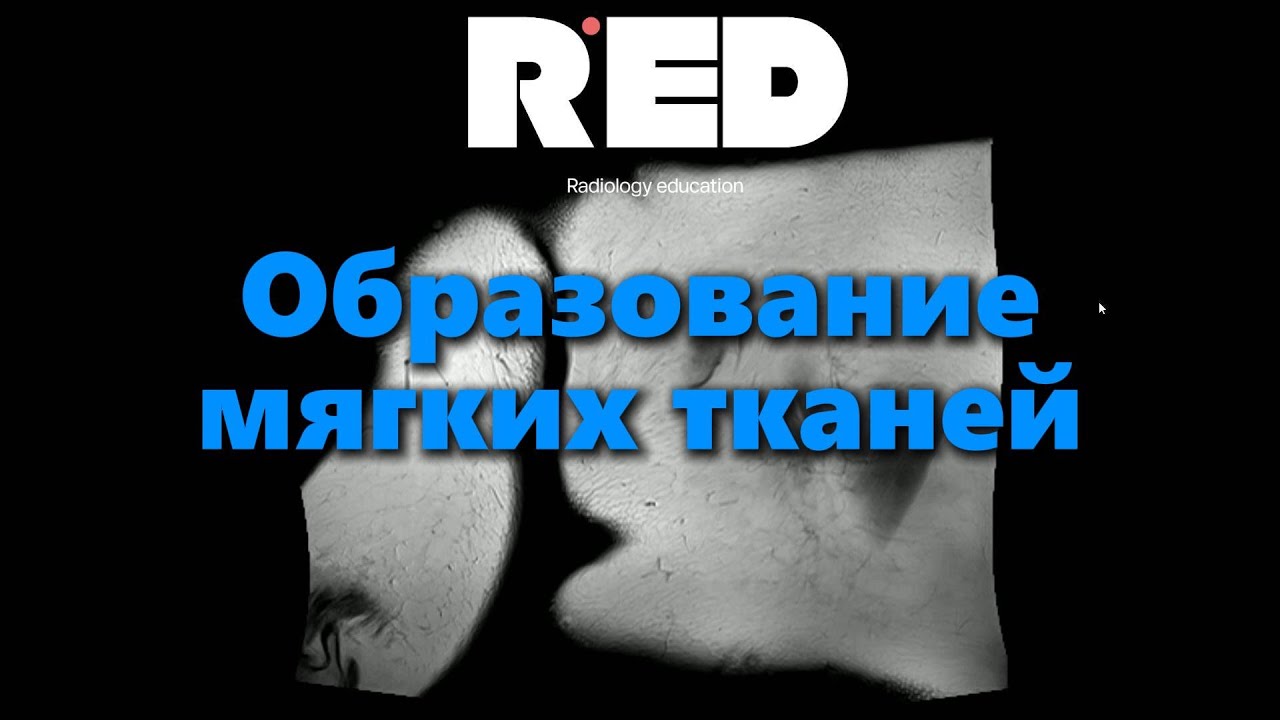 Образования мягких тканей на МРТ