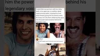 Freddie Mercury Was Born With Four Extra Teeth In His Upper Jaw A Condition Called Supernumerary