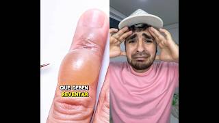 Así es que se hacen las ampollas 😱 #viral #datoscuriosos #yosoydelos7mil #parati #dúo