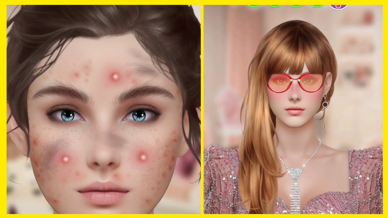 [asmr animation] girl treatment infectionon face asmr satisfying |asmr acne removal| acne treatment