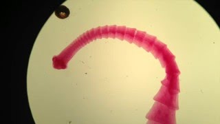 Dipylidium caninum