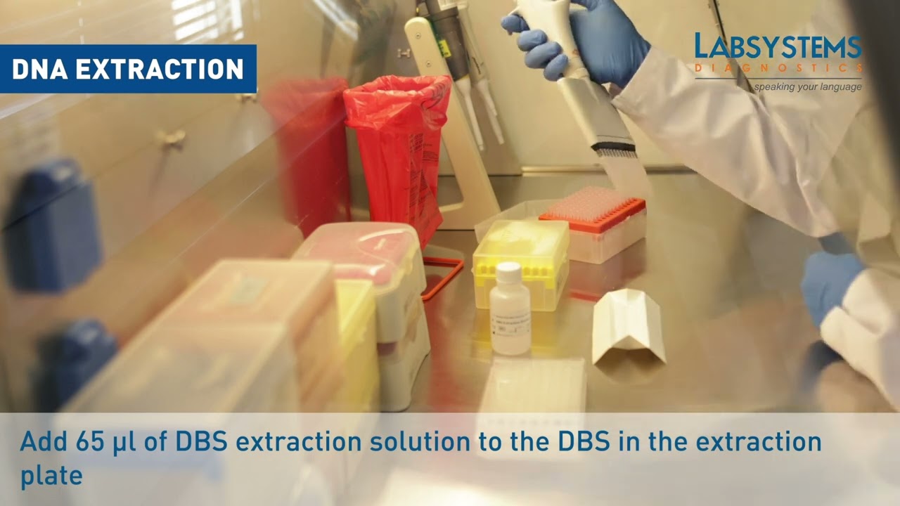 Labsystems Diagnostics: NeoNat SCID SMA Kit