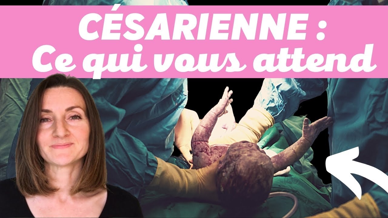 COMMENT SE PASSE UNE CÉSARIENNE ? PRÉPAREZ-VOUS (SANS TABOU) - YouTube