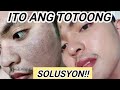 TOTOONG SOLUSYON SA PEKAS SA MUKHA! (Dark Spots, Melasma, etc.)