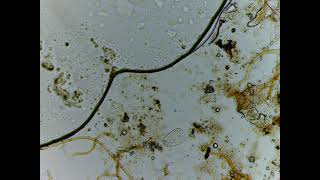 Testate Amoeba (likely Arcella sp. or Centropyxis)