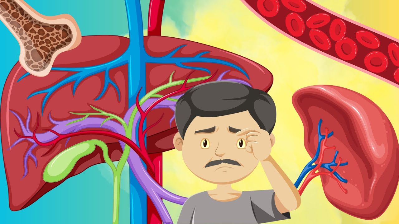 METABOLISMO de BILIRRUBINA