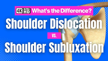 Shoulder Dislocation vs. Shoulder Subluxation #3d #4k #shoulder