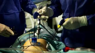 видео Абдоминальная хирургия за границей: новейшие методики