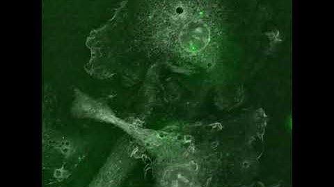 Tumor-derived extracellular vesicles uptake in mouse macrophages - with Nanolive imaging