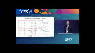 Transforming Small Cell Lung Cancer Treatment Through Emerging Evidence and Expert Insights
