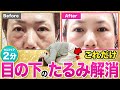 【激変】毎日2分だけ!目の下のたるみがどんどん消える骨格ワーク
