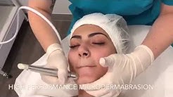 Microdermabrasion -Skincare LASER Clinic Point Cook Melbourne 