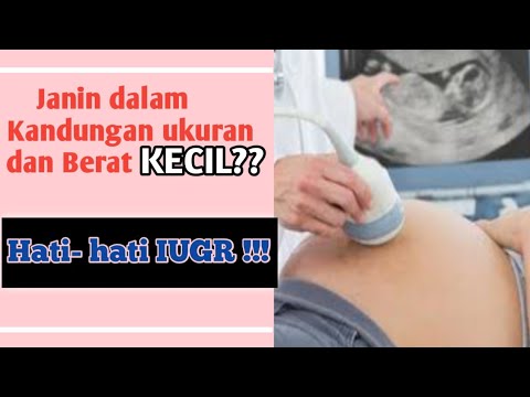 Video: Apakah IUGR asimetri?