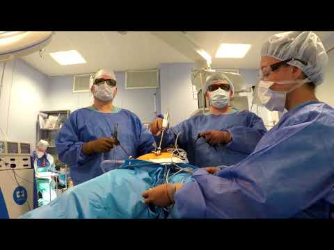 Видео: Можно ли провести лапароскопическую гистерэктомию без морцелляции?