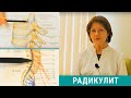 Радикулит: симптомы и лечение радикулита