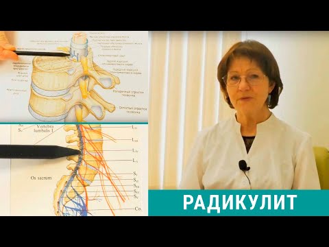 Поясничный радикулит симптомы и лечение в домашних условиях