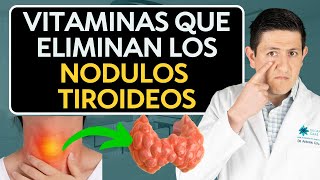 How to eliminate Thyroid Nodules Dr. Antonio Cota Sugar Care