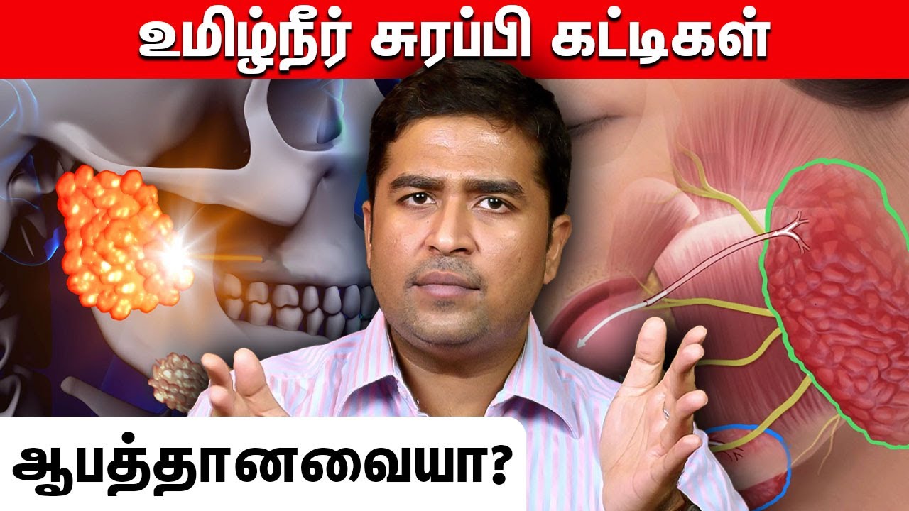 உமிழ்நீர் சுரப்பி கட்டிகள் ஆபத்தானவையா? | Dr Vignesh Ent