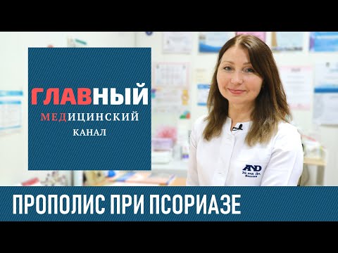 Лечение псориаза прополисом. Эффективная мазь от псориаза на коже в домашних условиях