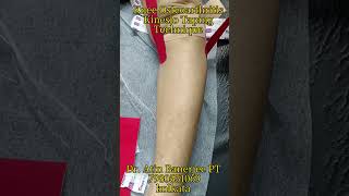 Knee Osteoarthritis Kinesio-Taping Treatment Technique