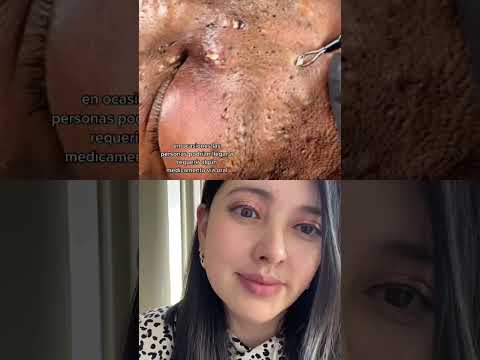 Vídeo: 4 maneres de netejar-se profundament la cara