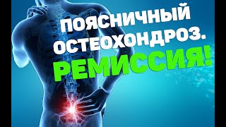 Поясничный Остеохондроз. Ремиссия | Лфк Упражнения