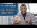 MINI-IMPLANTE ORTODÔNTICO: PARA QUE SERVE E QUANDO É INDICADO? (com Dr. Pedro Albertoni)