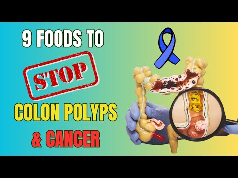 9 Foods to Eliminate Colon Polyps and Prevent Bowel Cancer