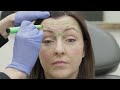 Botox Training Toronto