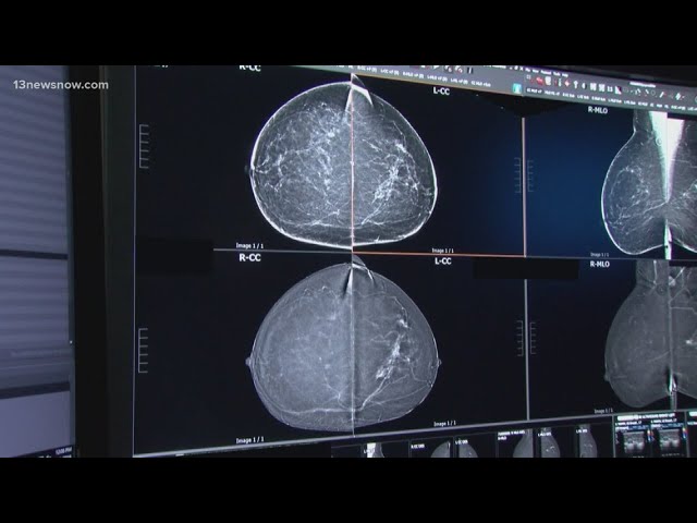 Reaction to new breast cancer screening recommendations