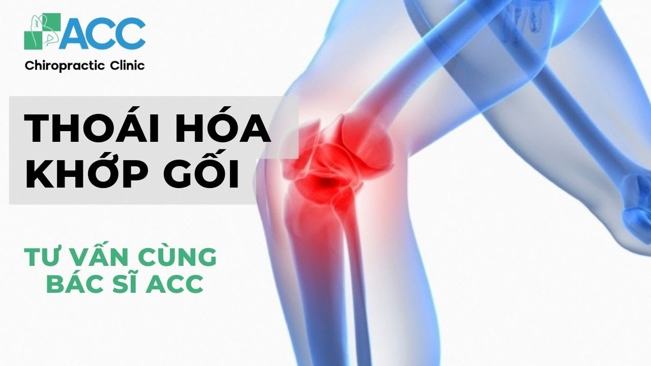 Thoái hóa khớp gối: Nguyên nhân, triệu chứng, cách điều trị | ACC