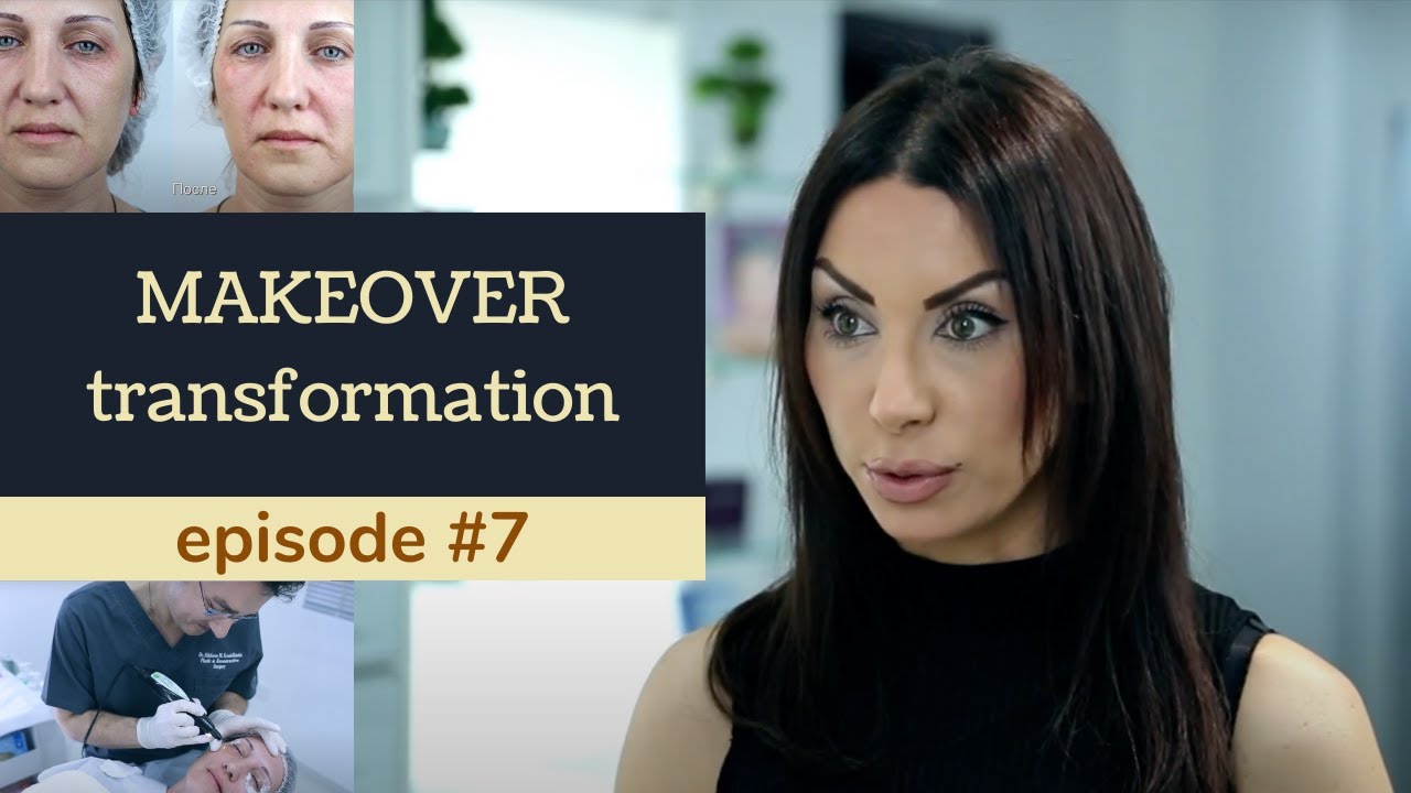 BOTOX & FILLERS: MY FIRST EXPERIENCE. Makeover transformation. Ep 7.