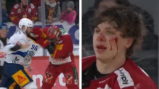 Eder vs Guggenheim Fight in National League