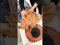 [ASMR] 热拔罐 - Heat Cupping Therapy