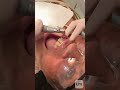 Facetas Dentárias: A Etapa 1 para o Sorriso dos Sonhos ✨