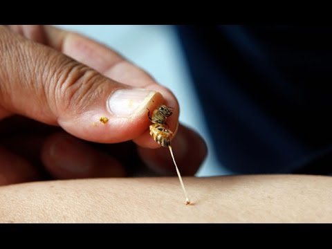 वीडियो: क्या आपको डंक मारने पर मधुमक्खी मर जाएगी?