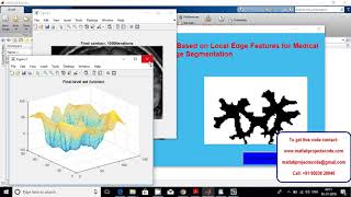 Weighted Level Set Evolution Based on Local Edge Features for Medical Image Segmentation