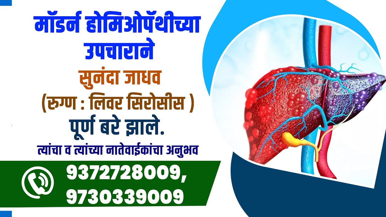 SUCCESS STORY OF LIVER CIRRHOSIS CURED PATIENT WITH MODERN HOMEOPATHIC