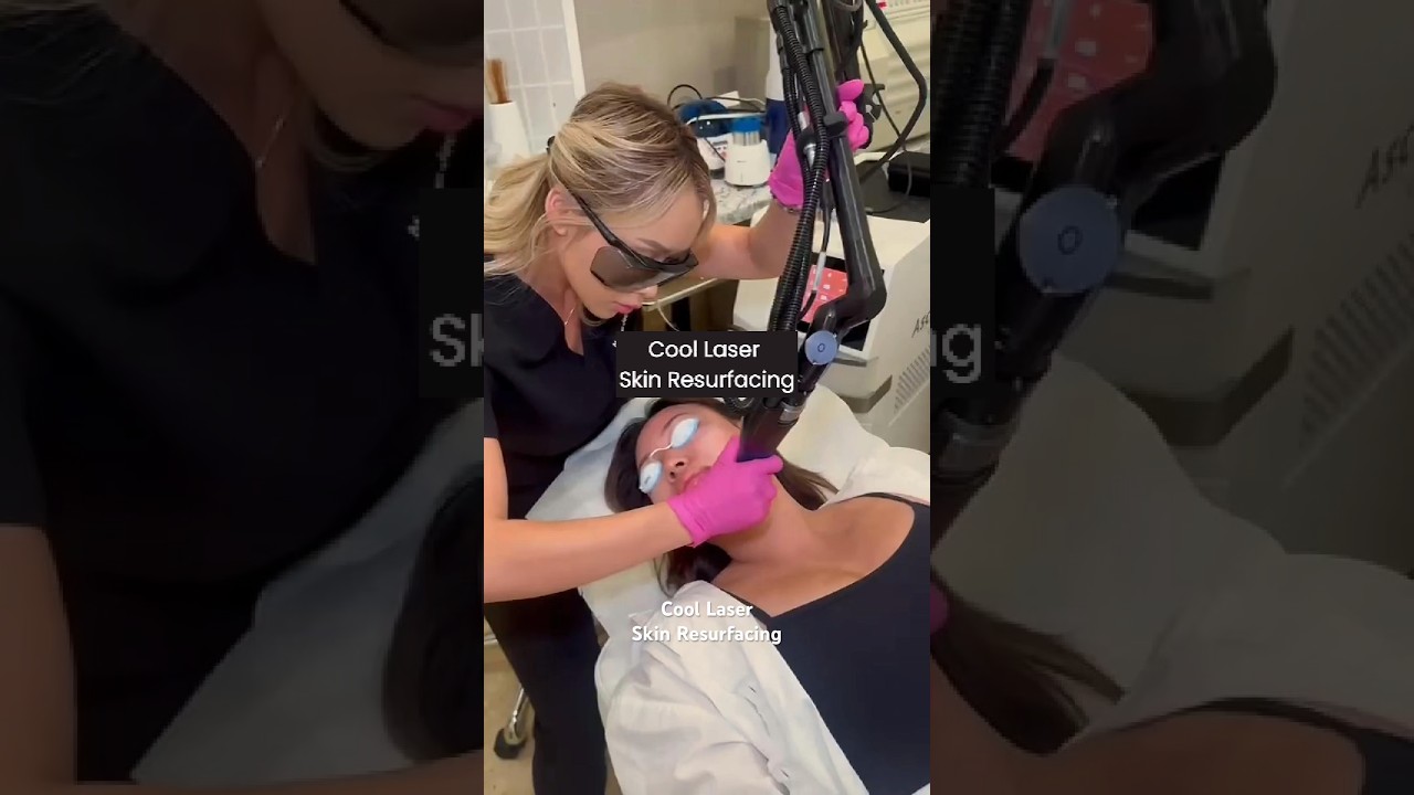 Radiant Skin in Seconds: Halo Laser Resurfacing, Before and After