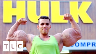 Bodybuilder Injects Himself Unregulated Oil Real Life Hulks