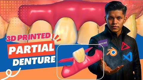 3D Printed Removable Partial Denture Design | Exocad Splint File Workflow | Ratanician