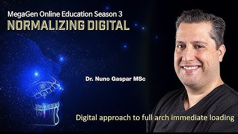 Digital approach to full arch immediate loading