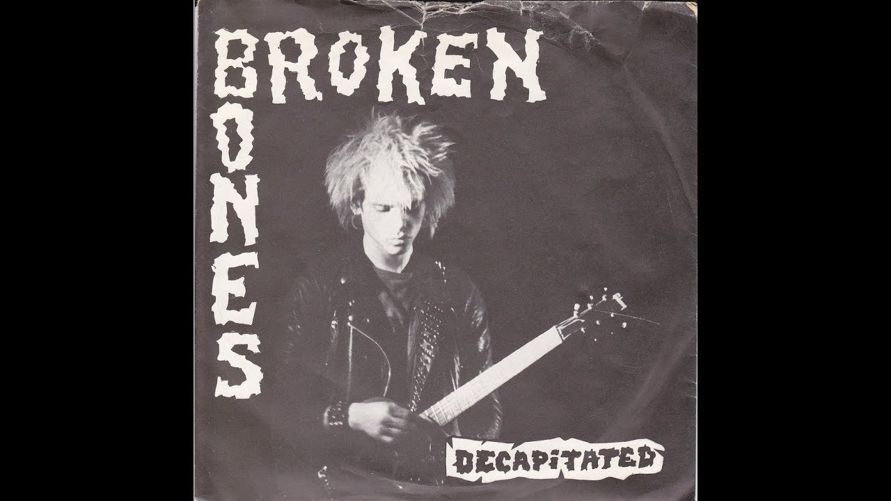 BROKEN BONES compilation 1