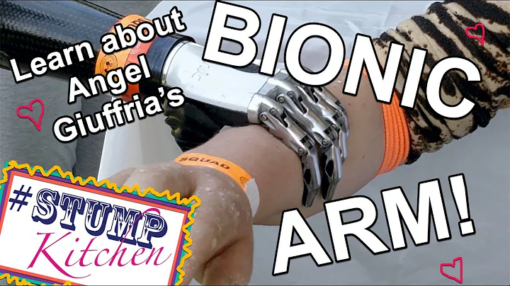 Learn about Angel Giuffria's Bionic arm! (I know a Cyborg!)