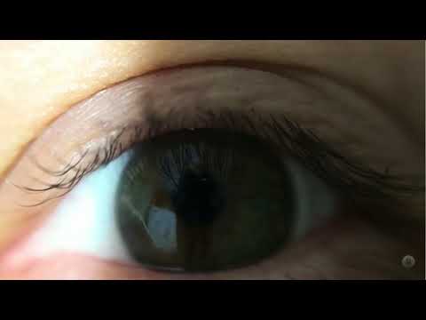 Iris laid bare