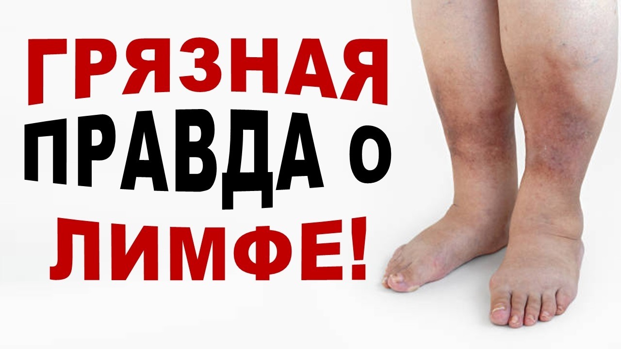 Эти советы точно помогут избавиться от отеков! Грязная правда о лимфе!