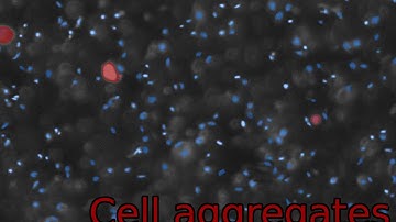 Chemostat Image Processing - Image Segmentation